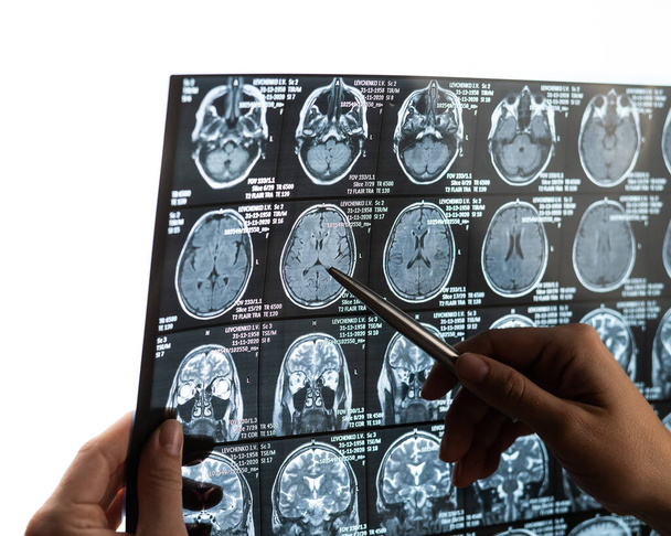 A female doctor examines an MRI scan of the brain - Fotoğraf, Görsel