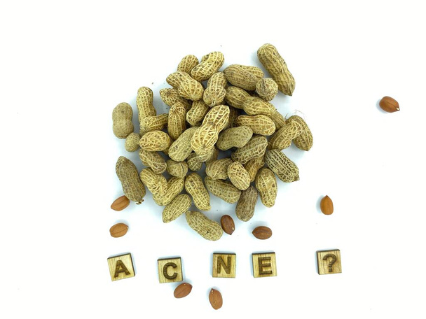 Problemas de salud de los cacahuetes, micotoxinas y ACNE. Beneficios para la salud y efectos secundarios.  - Foto, Imagen