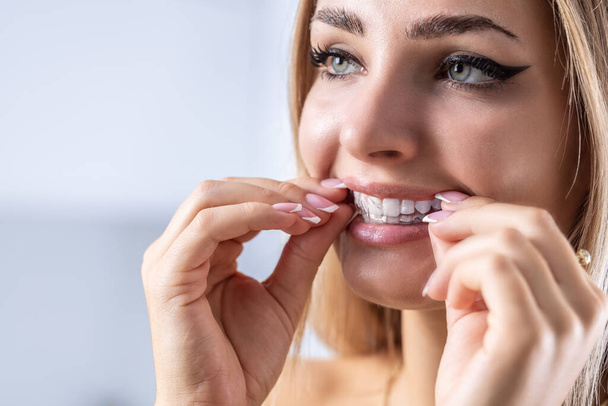 A woman puts on an invisible silicone teeth aligner. Dental braces for teeth correction. - Foto, Imagen