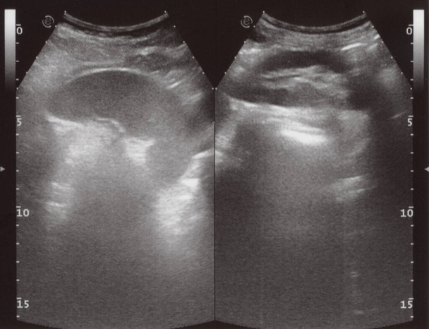 full abdomen ultrasound image aka diagnostic sonogram - Foto, afbeelding