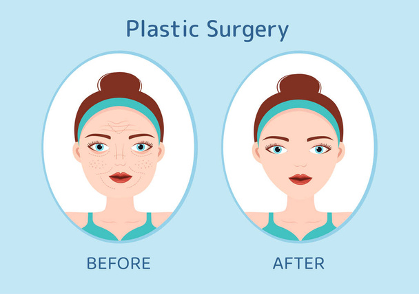Πλαστική Χειρουργική Επίπεδη Cartoon χέρι σχεδιάζεται Πρότυπα Εικονογράφηση της Ιατρικής Χειρουργικής Λειτουργίας στο σώμα ή το πρόσωπο, όπως αναμένεται με τη χρήση προηγμένου εξοπλισμού - Διάνυσμα, εικόνα