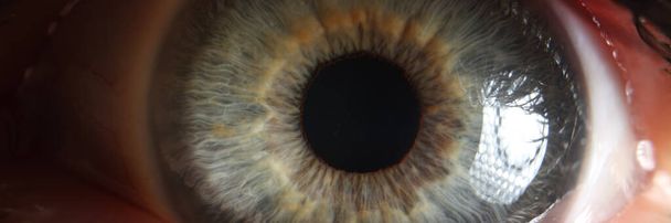 Macro uitzicht op open grijs oog, kleine pupil. Behandeling van oogziekten, visusproblemen, angstige blik - Foto, afbeelding