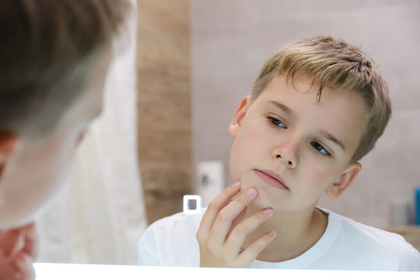 Reflectie van een tiener geïrriteerd door droge ongezonde huid, bezorgd over problemen met zijn gezicht. ongelukkige tiener jongen aanraken van zijn wang, het gevoel gestrest van vette huid of acne in de badkamer. - Foto, afbeelding