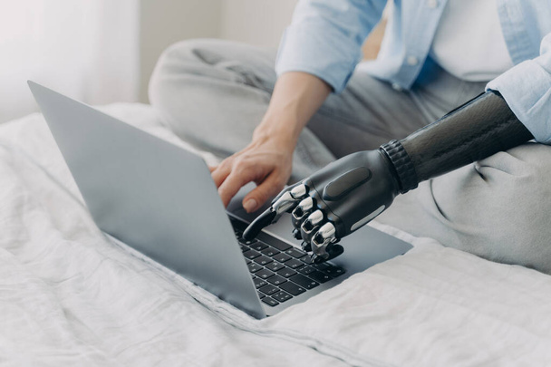 Zbliżenie niepełnosprawnej kobiety pracującej na laptopie, piszącej na klawiaturze, używając bionicznego protetycznego ramienia, siedzi na łóżku. Kobieta z niepełnosprawnością używa klawiatury przez sztuczną rękę robota. Nowoczesna reklama protezy. - Zdjęcie, obraz