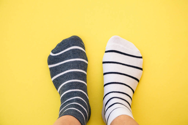 Merkwürdiges Socken-Tag-Konzept. Beine in verschiedenen Socken auf blauem Hintergrund. Ansicht von oben. - Foto, Bild