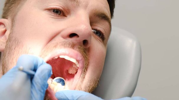 Крупный план лечения молодняка во время стоматологического лечения. Обследование с помощью зубного зеркала - Фото, изображение