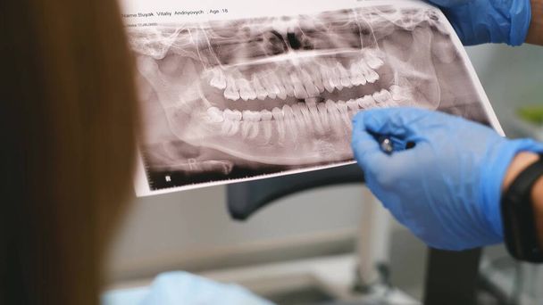 A young dentist shows an x-ray of the patients mouth. Dentist consultation - Foto, imagen