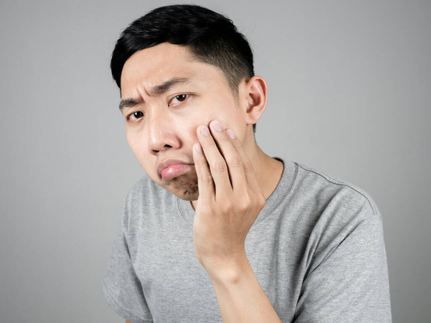 De cerca asiático hombre gris camisa se siente preocupado por el acné de su cara aislado - Foto, Imagen