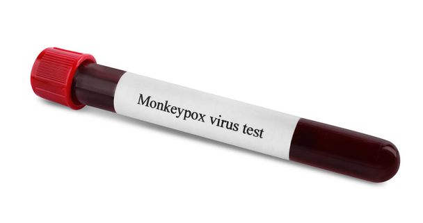 Monkeypox virus test. Sample tube with blood isolated on white - Foto, Bild