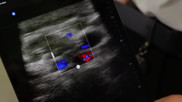 Diagnóstico da área do pescoço com um scanner de ultra-som, o médico examina a doença com a ajuda de raios-x na clínica - Filmagem, Vídeo