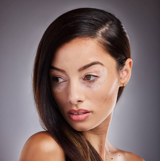 Beauty, face and vitiligo with a model woman in studio on a gray background for natural hair care. Wellness, luxury and cosmetics with a young female posing for dermatology, wellness or pigmentation. - Foto, imagen