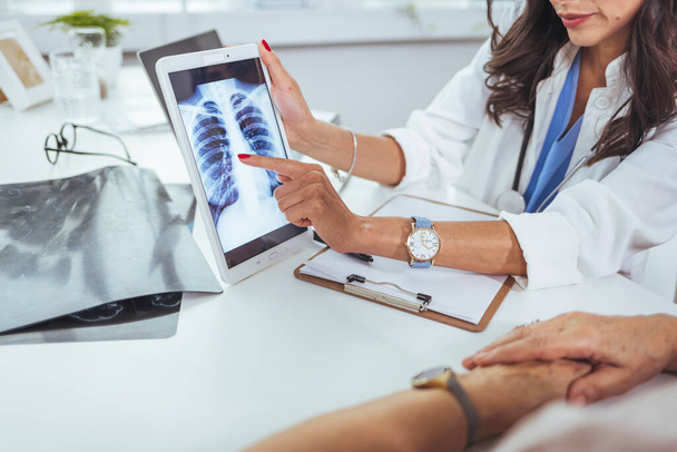 Doctor shows results to old patient x-ray of the lungs, smoking cigarettes problem. Doctor explaining lungs x-ray on Tablet PC screen to young patient. Doctor showing female patient x-ray shot in clinic office. Coronavirus chest X-ray. - Foto, Imagem