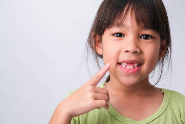 Portret Azjatki ze złamanymi górnymi zębami dziecka i pierwszymi stałymi zębami. Przyjazna dziewczynka pokazuje połamane zęby na białym tle. - Zdjęcie, obraz