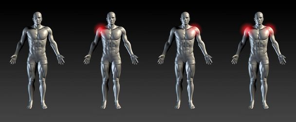 3D рендеринг человеческого тела с мышцами, травмой плеча - Фото, изображение