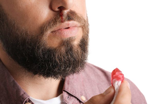 Young bearded man with nosebleed and tissue on white background, closeup - Фото, зображення