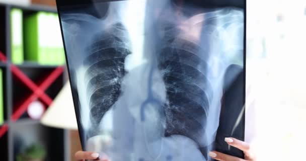 Il dottore esamina la radiografia dei polmoni in clinica. Polmonite bronchite coronavirus infezione e iniezione polmonare - Filmati, video