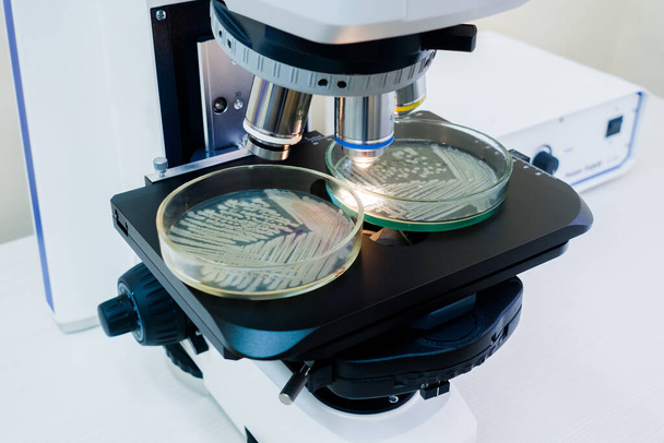 "Two Petri dishes under the microscope." - Фото, зображення