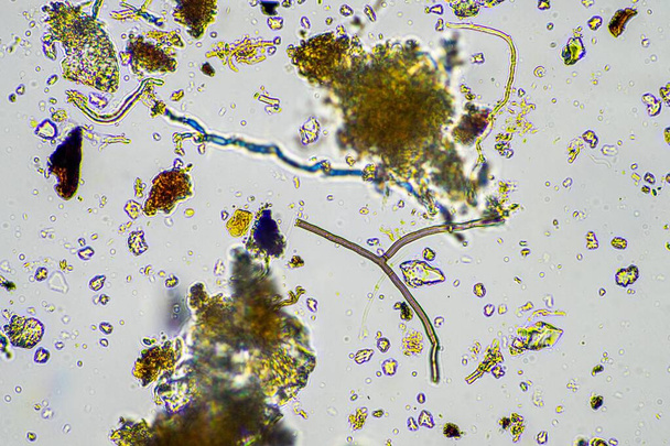 mikroorganizmalar ve toprak biyolojisi, mikroskop altında nematodlar ve mantarlar. İlkbaharda toprak ve gübre örneğinde. - Fotoğraf, Görsel