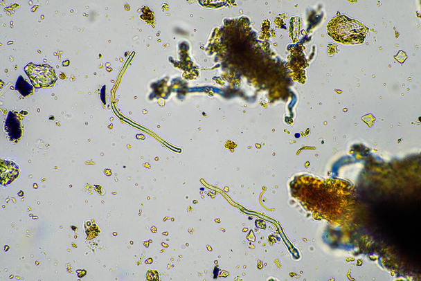 mikroorganizmy i biologia gleby, z nicieniami i grzybami pod mikroskopem. w próbce gleby i kompostu wiosną - Zdjęcie, obraz