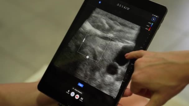 Ultra-sonografia do corpo de um homem por um médico em um centro de diagnóstico de saúde - Filmagem, Vídeo