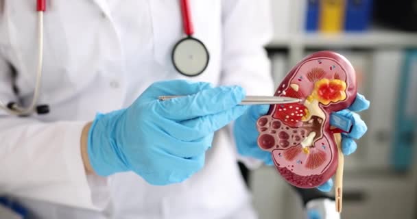Dokter uroloog houdt model van nier close-up. Niertransplantatie en verwijdering van nierstenen concept - Video