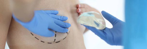Plastický chirurg drží silikonový hrudní implantát pro zvětšení prsou. Plastická chirurgie pro koncepci korekce prsou - Fotografie, Obrázek