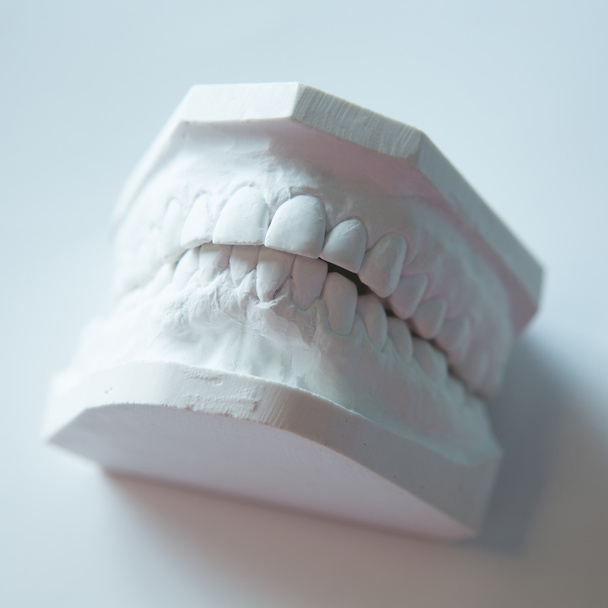 Gypsum model of human jaw on a white background. - Fotó, kép
