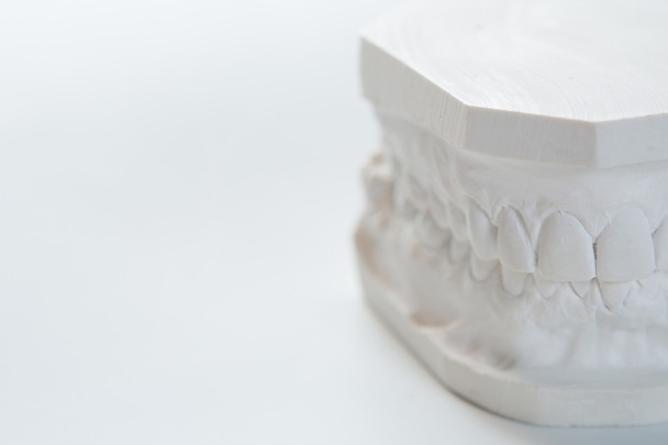 Gypsum model of human jaw on a white background. - Φωτογραφία, εικόνα