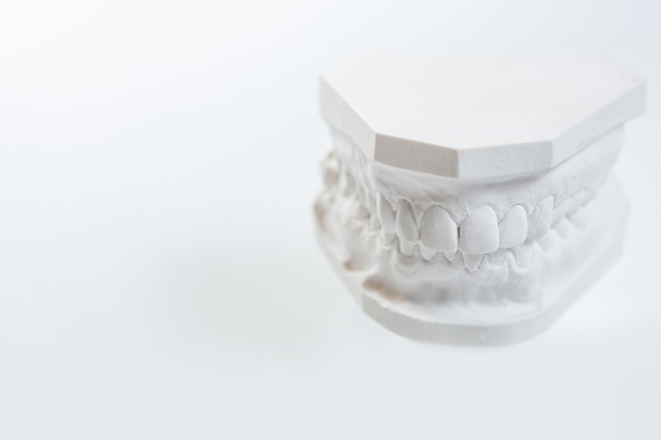 Gypsum model of human jaw on a white background. - Photo, image