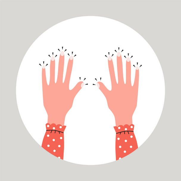 Tingling and numbness in the hands. Finger sensitivity problem. Flat vector illustration. - Вектор, зображення