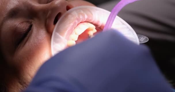 Female patient with mouth retractor during treatment in dentist office. Dentists tools and treatment and teeth whitening - Footage, Video