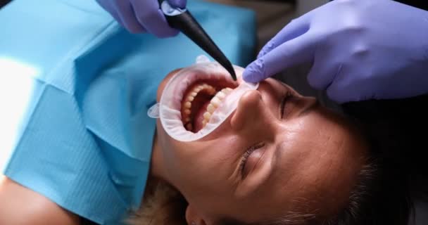 Diş kliniğinde ağzı retraktörlü ve dişlerini suyla fırçalayan bir kadın. Diş hekimi tükürük çıkarıcı ya da diş pompası kullanıyor - Video, Çekim