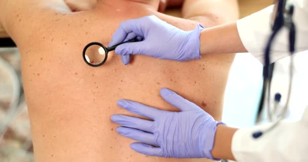 Δερματολόγος εξετάζει το δέρμα στην πλάτη του ασθενούς closeup. Δερμοσκόπηση κρεατοελιές και καρκίνο του δέρματος - Πλάνα, βίντεο