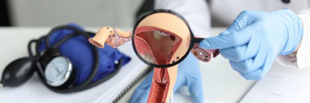 Close-up of doctor show patient on reproductive system model, explain problem to client, magnifying glass. Medical checkup, gynecology, analysis concept - Photo, image
