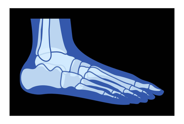 X-Ray Foot Legs Skeleton Human body Bones - malleolus, Phalanges adult people roentgen side view. Realistic flat blue color concept Vector illustration of medical anatomy isolated on black background - Vector, Image