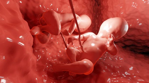 3d medisch nauwkeurige illustratie van tweelingen in de baarmoeder, Monozygotische tweelingen in de baarmoeder met enkele placenta, menselijke tweeling foetussen, prenatale groeiende baby, zwangerschap gezondheid en foetus, - Foto, afbeelding