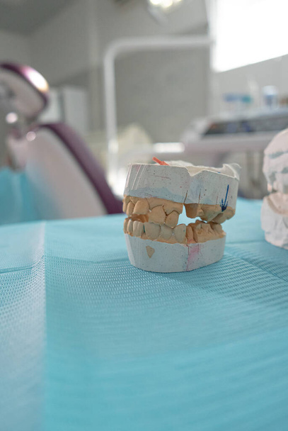 Ortodontický model - umělé čelisti detailní záběr s ortodontickou skříňkou na pozadí - Fotografie, Obrázek