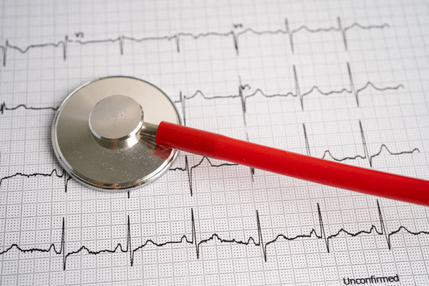 Stethoskop auf Elektrokardiogramm-EKG mit rotem Herzen, Herzwelle, Herzinfarkt, Kardiogramm-Bericht. - Foto, Bild