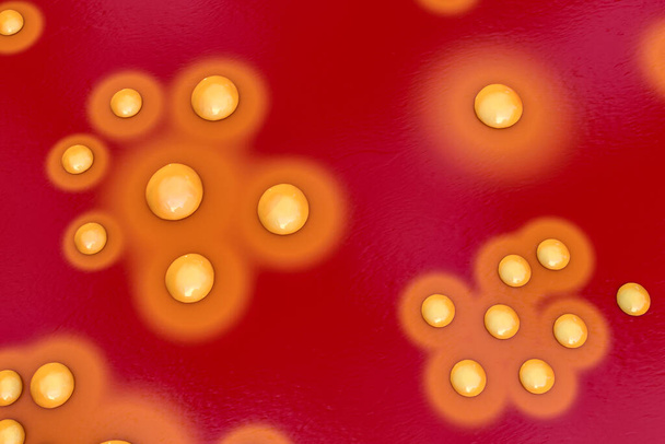 Colonias de bacterias Staphylococcus aureus en medio de agar de sangre de oveja, ilustración 3D - Foto, imagen