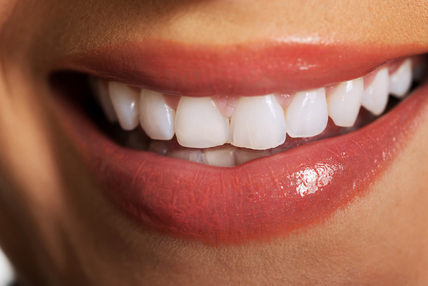 女性の白い歯にクローズ アップ - 写真・画像