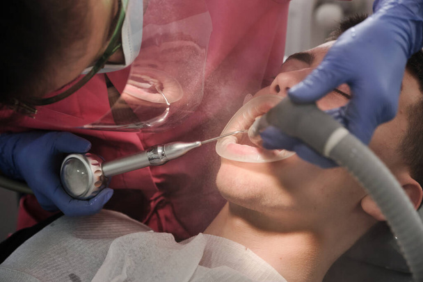 Top view of the process of brushing the patient's teeth. Brushing teeth with water jet and saliva remover. Retractor cheeks on the lips. The concept of professional oral hygiene. - Фото, зображення