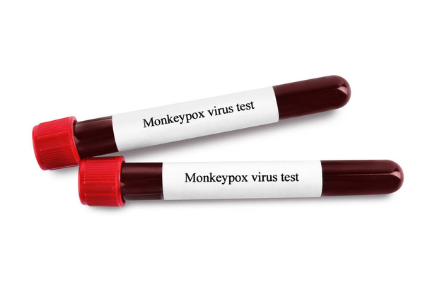 Δοκιμή ιού ευλογιάς μαϊμούς. Σωλήνες δειγματοληψίας με αίμα σε λευκό φόντο - Φωτογραφία, εικόνα