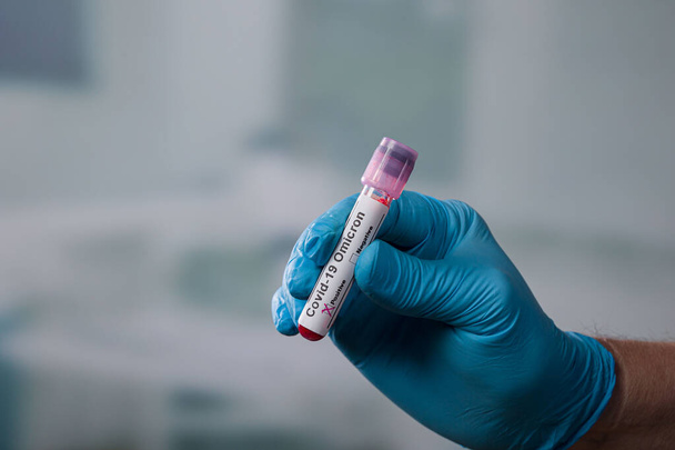 Hand in Hand mit blauem medizinischem Handschuh hantiert vor einem Laborraum mit einem Reagenzglas mit Coronamarkern - Foto, Bild