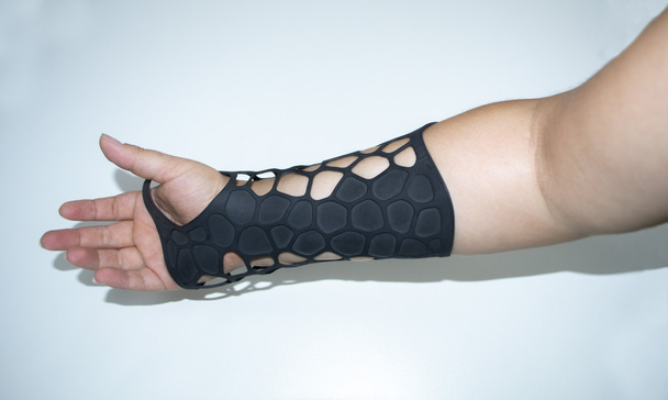 Ortopedyczna proteza z tworzywa sztucznego wydrukowana na druku proszkowym 3D pod ręką. Zbliżenie gipsu. Technologia druku 3D Multi Jet Fusion MJF. Nowoczesna postępowa technologia addytywna - Zdjęcie, obraz