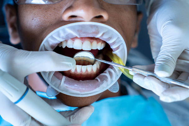Закрытие резиновой открывашки на пациента в стоматологическом кабинете - Фото, изображение