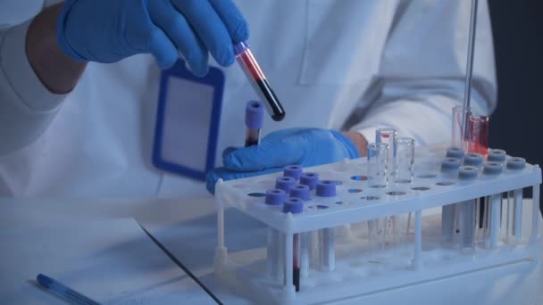 Patolog pracující v laboratoři se vzorky krve. Vědci zpracovávají vzorky DNA v laboratoři. Zdravotní péče, vyšetření krve, výzkum krve. Laboratorní pracovník připravuje preparát s krevními vzorky.  - Záběry, video