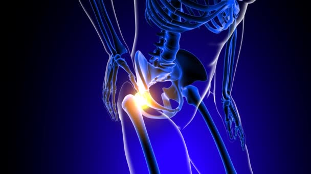 Anatomie de douleur articulaire de hanche pour l'animation 3D de concept médical - Séquence, vidéo