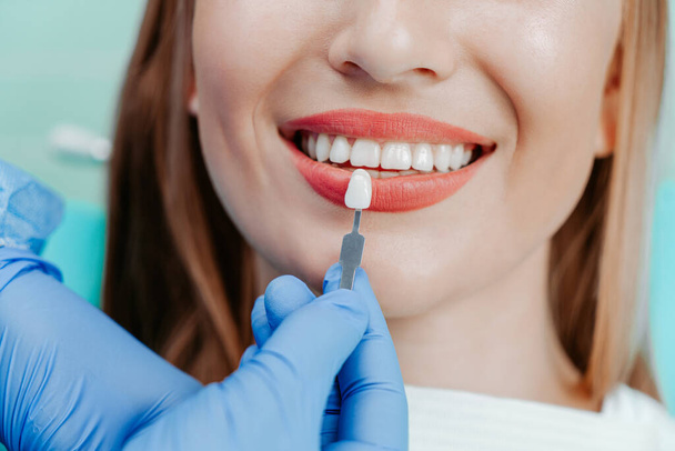 Smiling female mouth with natural white teeth in light blue background in dental clinic. Hands doctor dentist with teeth color palette next by face. Smile healthy teeth concept - Fotó, kép