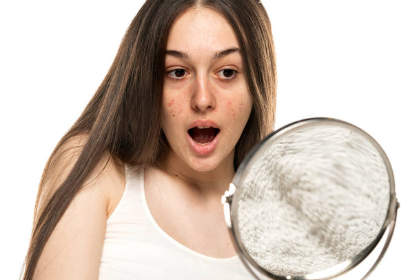 Egy megdöbbent lány problémás bőrrel nézi magát a tükörben fehér háttér - Fotó, kép