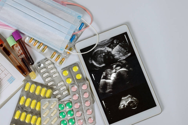 During prenatal ultrasound and cardiogram doctor will prescribe treatment to preserve baby in womb different medicines will be prescribed - Φωτογραφία, εικόνα
